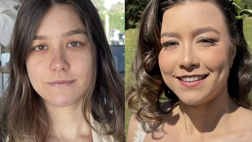 Short Video Antes e depois 