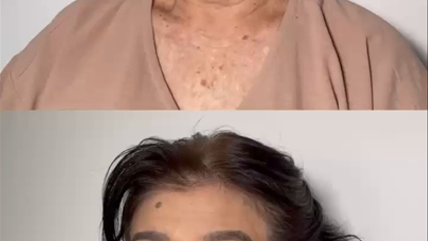Antes e depois cliente de pele madura e traços orientais 
