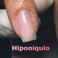 Unhas verdadeiras ou falsas? - 1