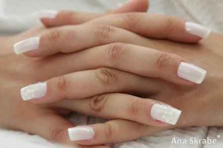 Unhas