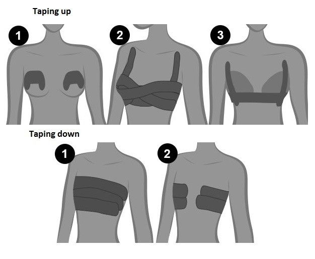 breast taping 1