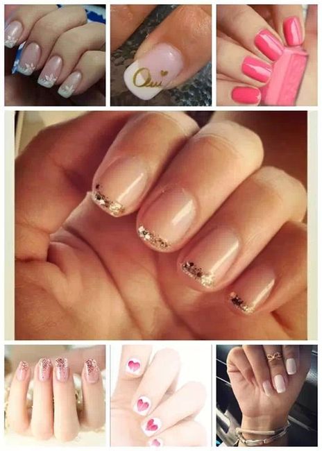 Unhas 