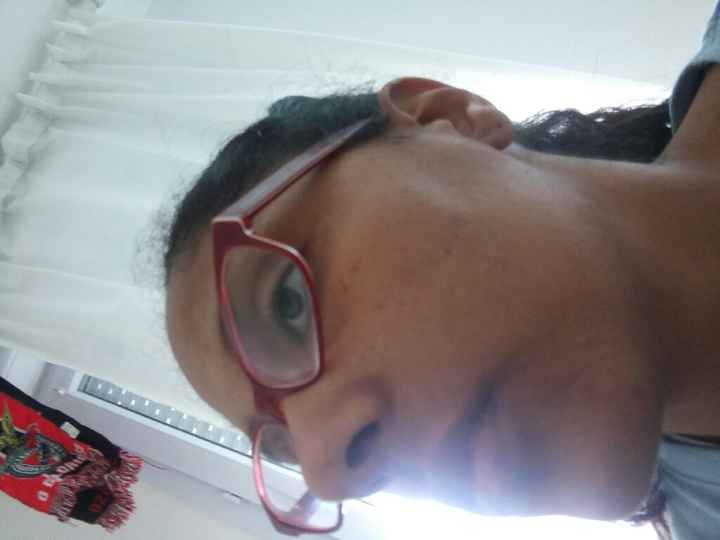 3 tratamento - 2