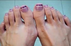 Foto5