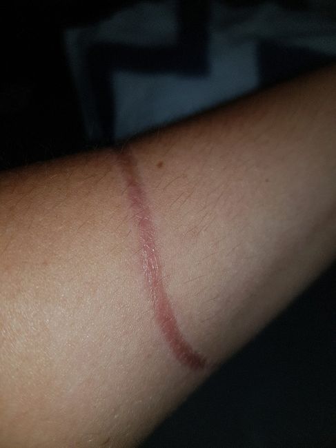 Cicatriz