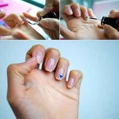 unhas