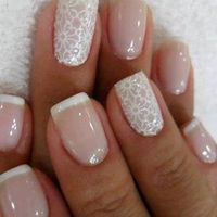 Unhas