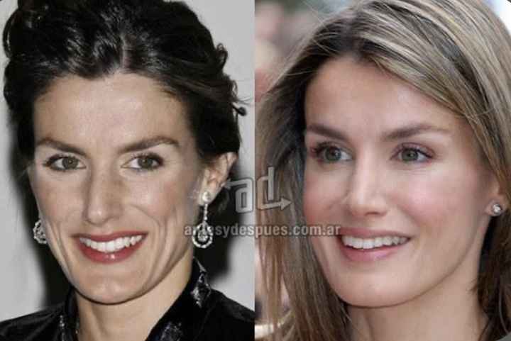 Leilão especial de famosos: quem dá mais por estes sapatos da rainha Letizia? - 1