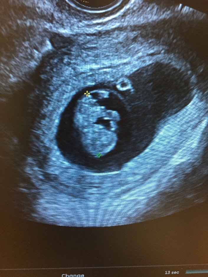 babyonboard