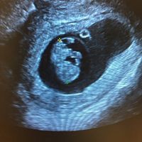 babyonboard