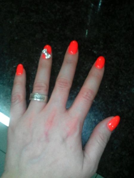 Unhas partidas! - 1