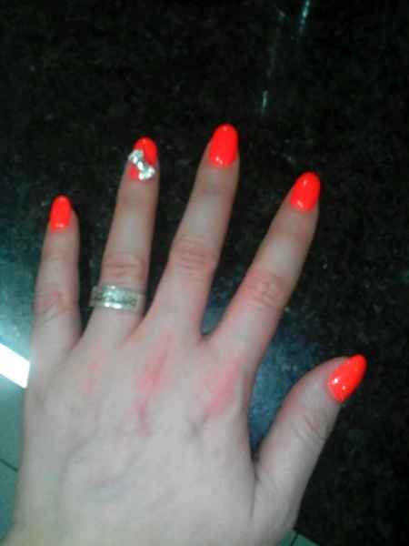 Unhas partidas! - 1