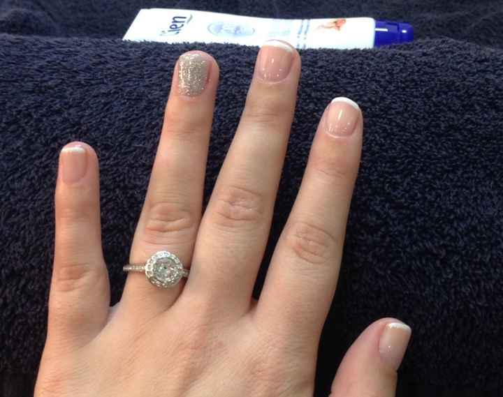 Unhas 