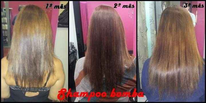 Queda cabelo - 1