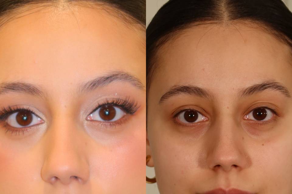 Before and After