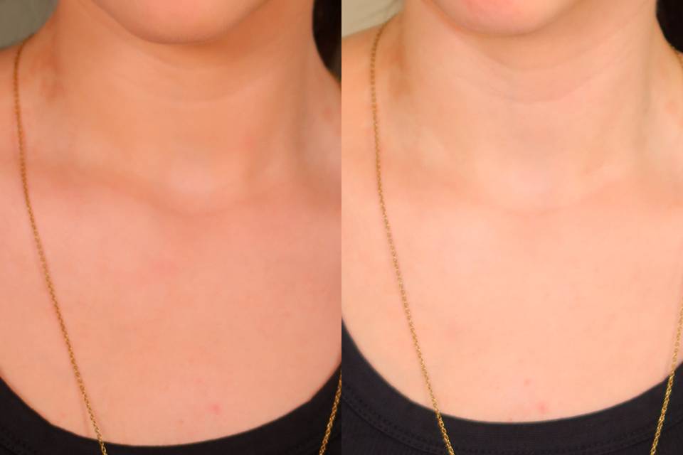 Before and After