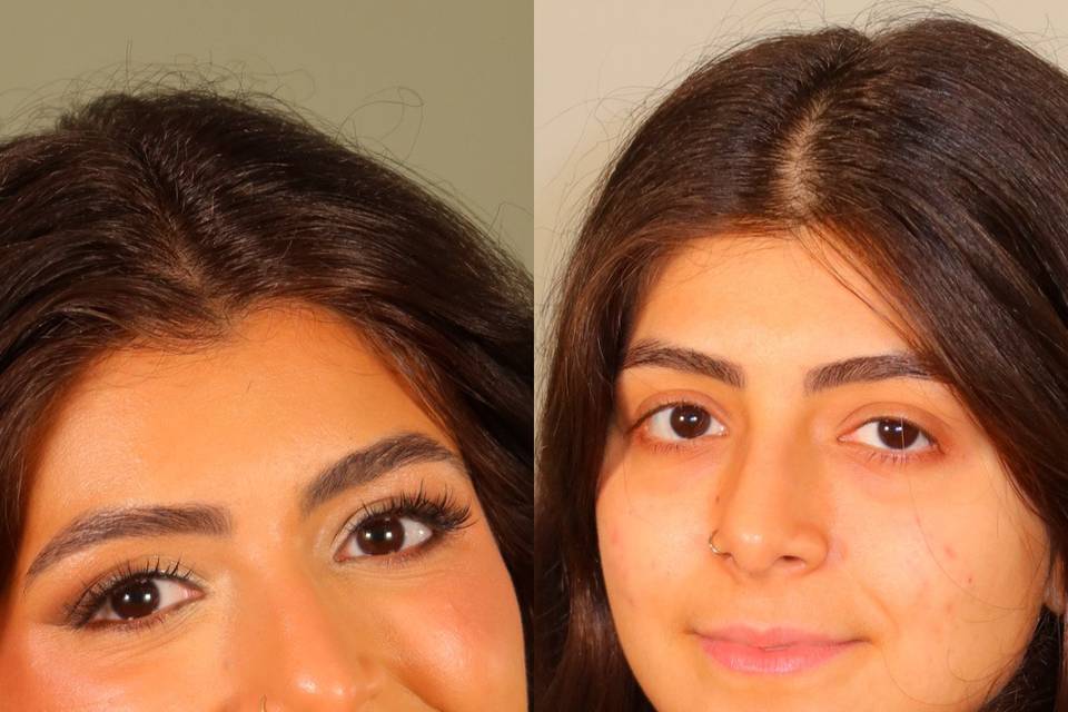 Before and After