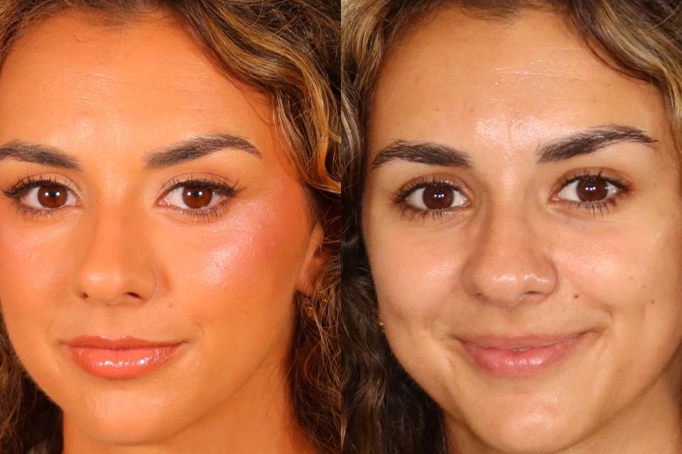Before and After