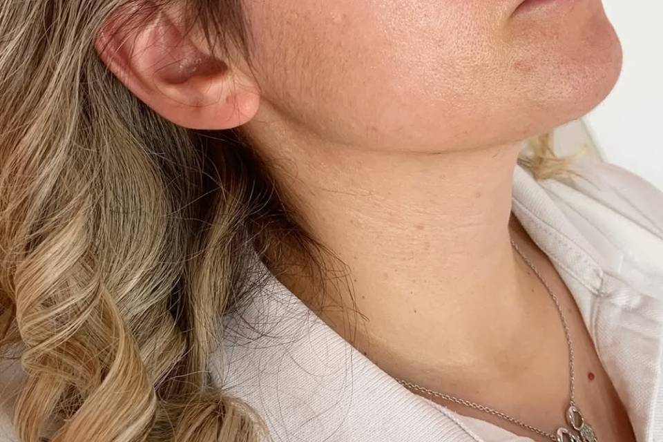 Estética