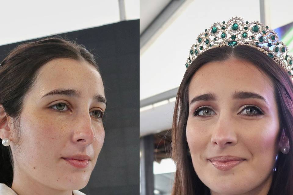 Antes e depois 