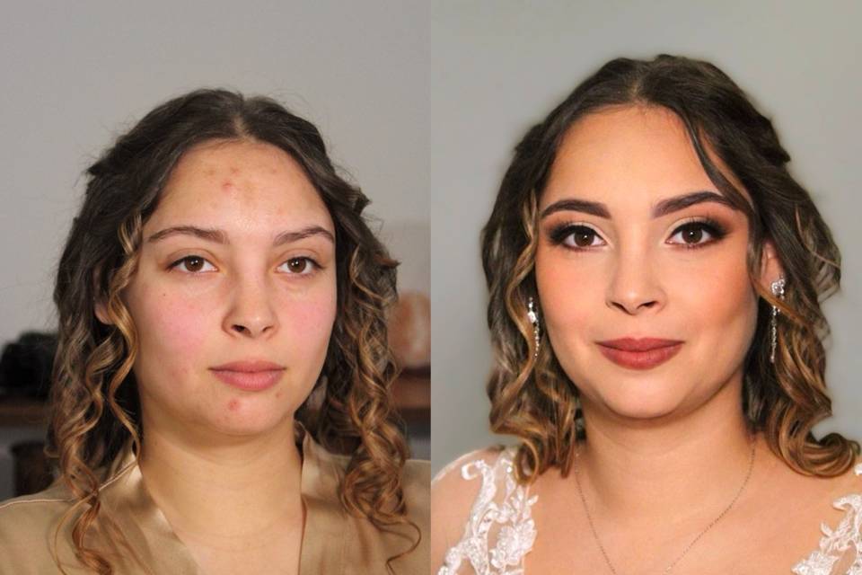 Antes e Depois