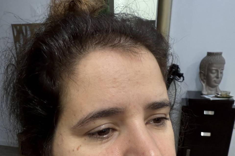 Antes