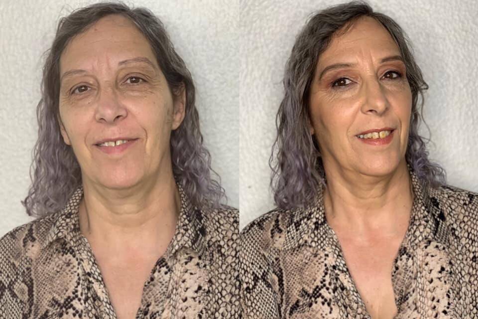 Antes e depois