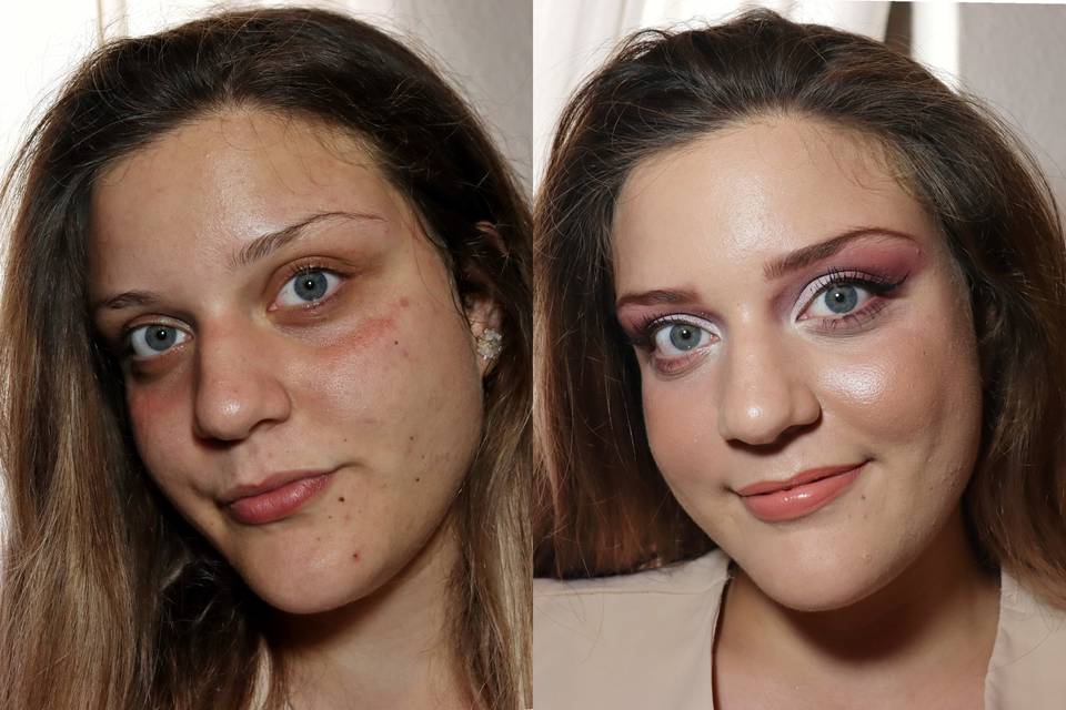 Antes e depois