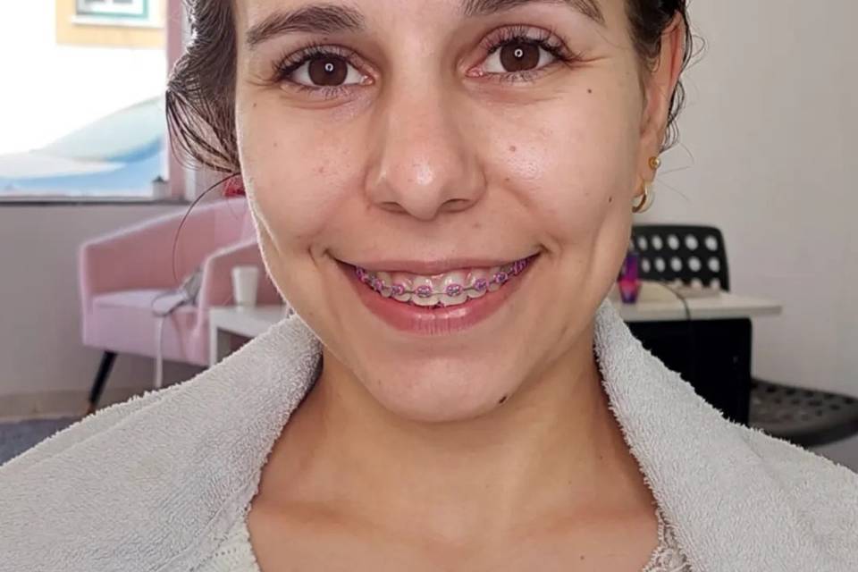 Antes