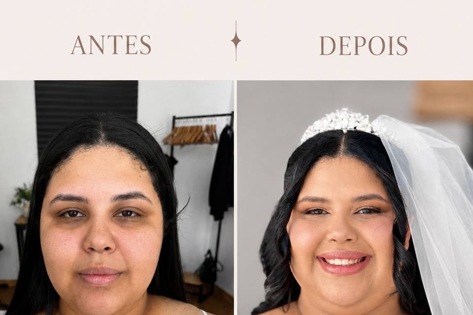 Antes X depois