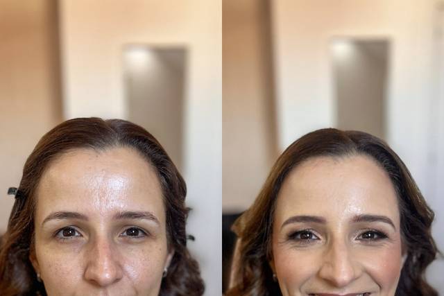 Antes e depois