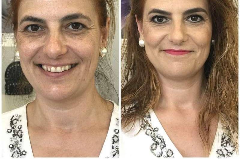 Antes e depois