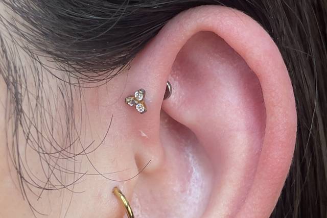 Forward hélix