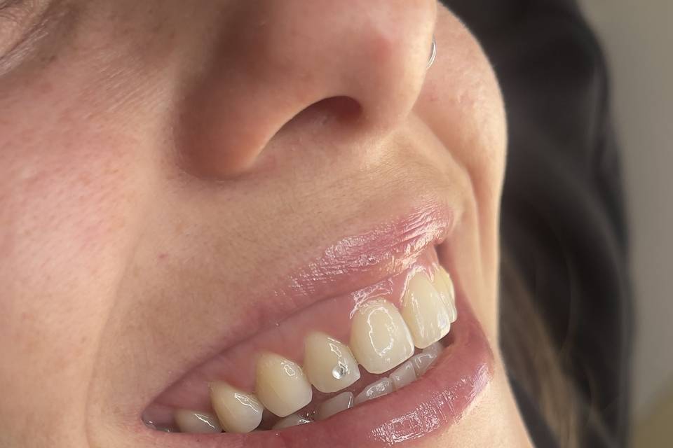 Tooth gem básico