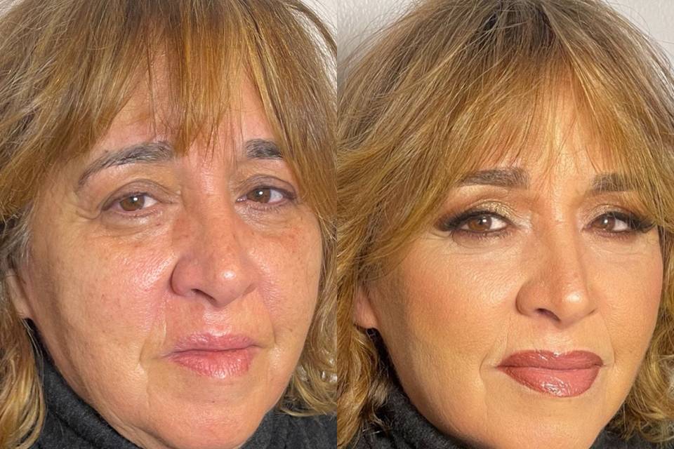 Antes e depois